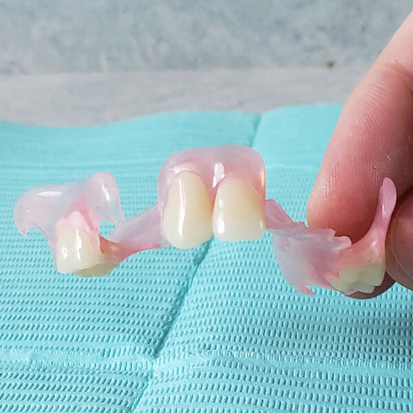 metal free partial denture